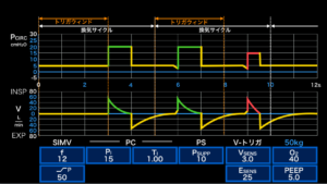 人工呼吸器のモード Simv の動き方 Pb840の場合